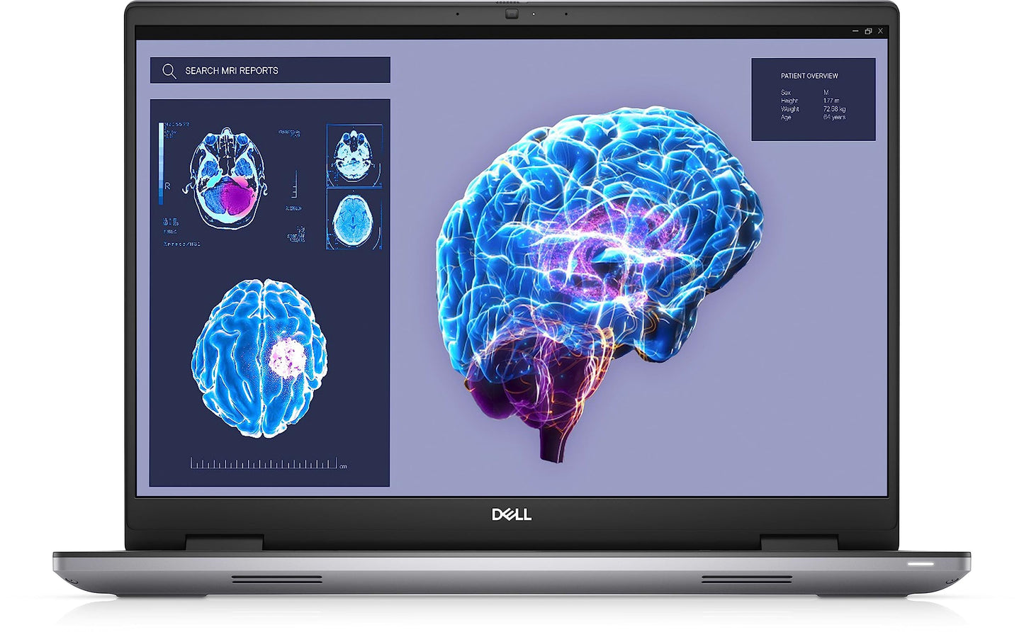 Ordinateur portable Dell Precision 7680 i7-13850HX 32 Go, SSD 512 Go, RTX 2000, écran 16" Full HD+