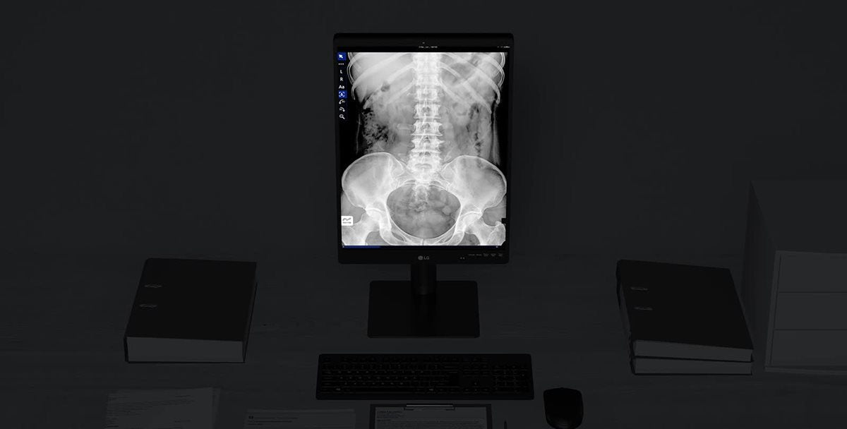 Moniteur de diagnostic LG 21,3'' 3MP IPS, 2048 x 1536, 1100 nits, antireflet