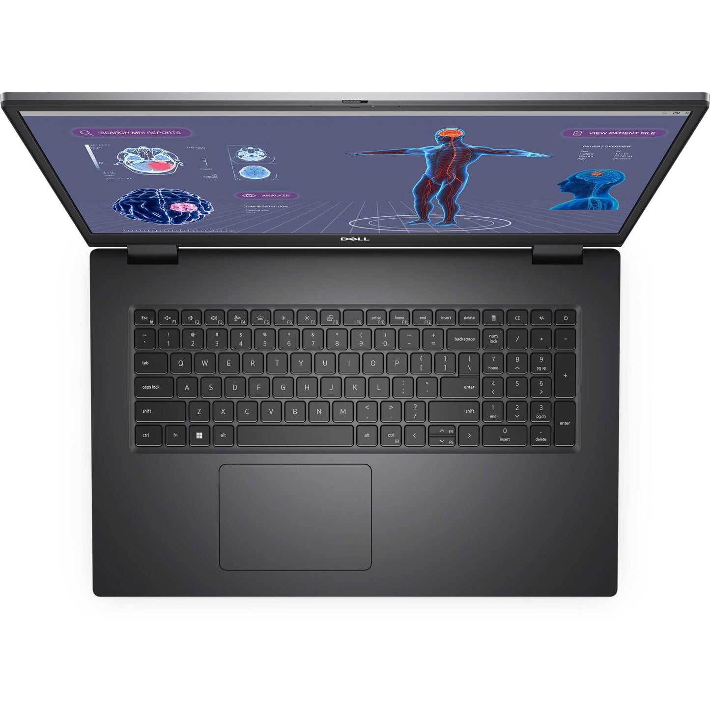 Station de travail Dell Mobile Precision 7780, i7-13850HX, 32 Go, SSD 512 Go, RTX 2000