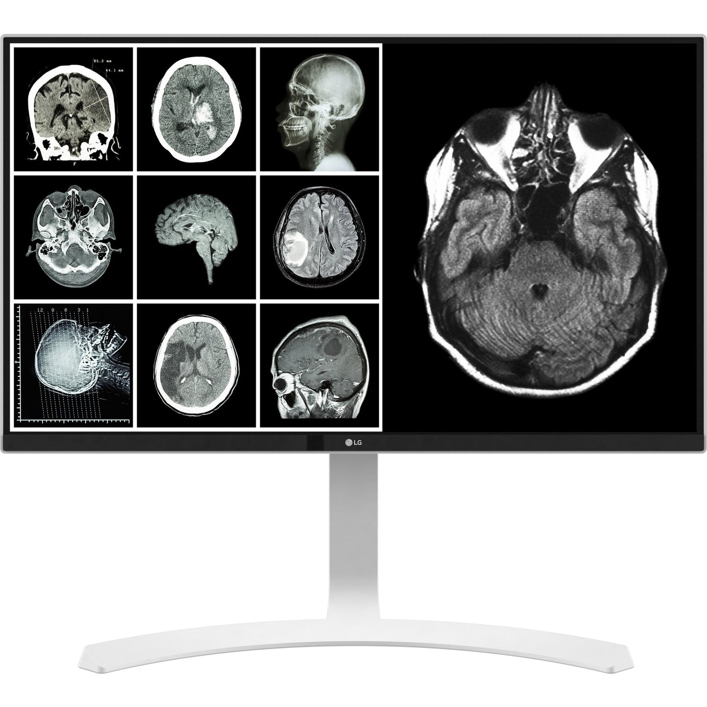 Moniteur clinique LG 27HJ713C-B 27 pouces 8 MP UHD, DICOM, HDMI/DP, TAA