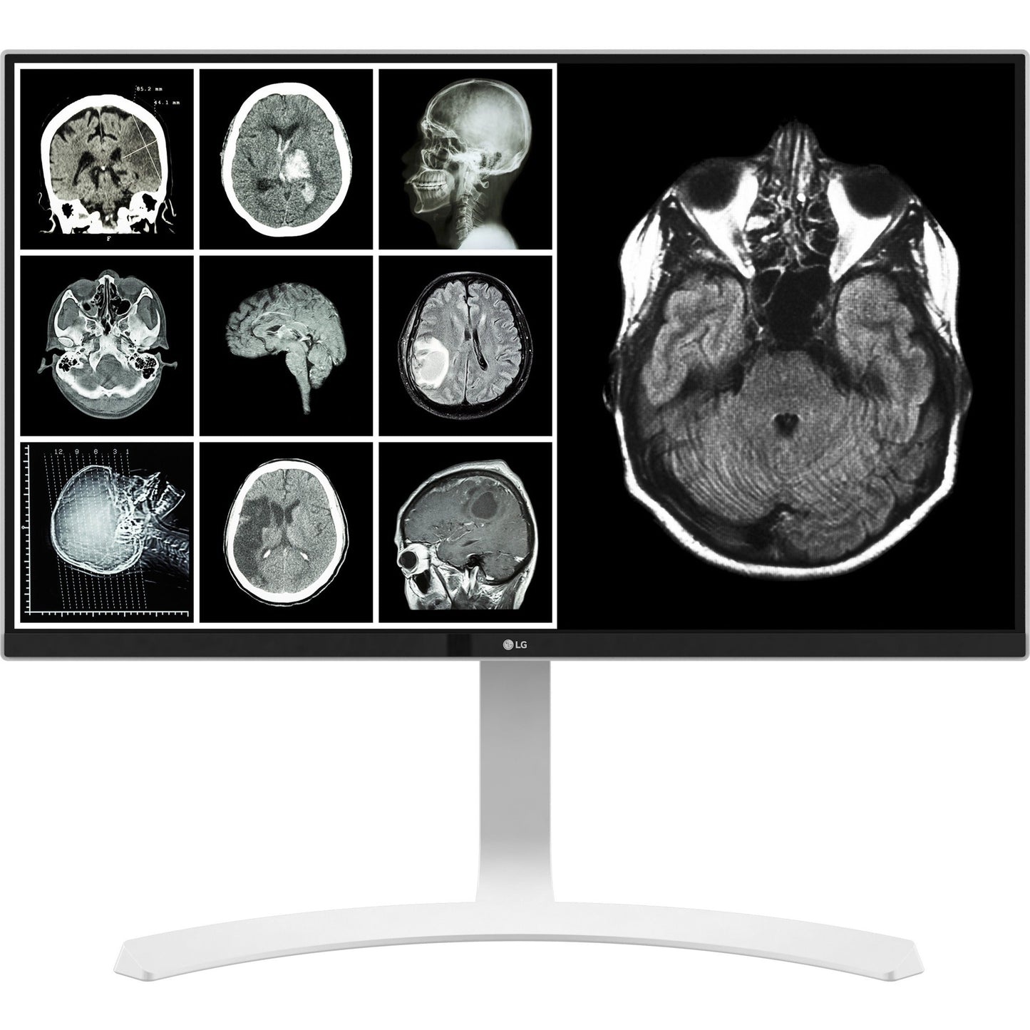 Moniteur clinique LG 27HJ713C-B 27 pouces 8 MP UHD, DICOM, HDMI/DP, TAA