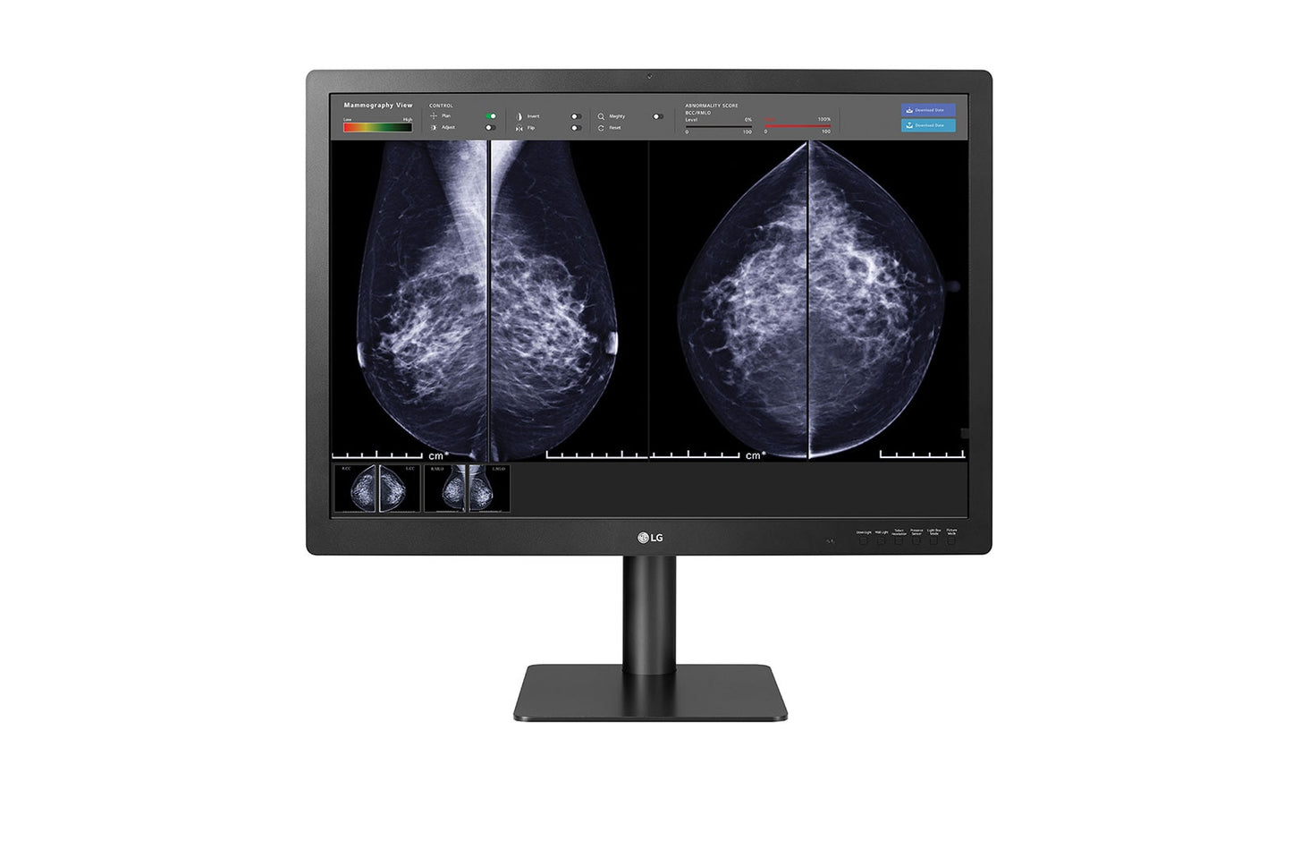 Moniteur de diagnostic médical LG 31HN713D-B 31 pouces, 4200 x 2800, antireflet, classe II FDA