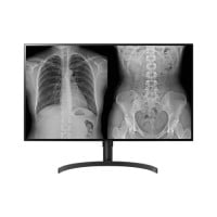 Moniteur de diagnostic médical LG 32HL512D-B 32 pouces 8MP IPS, FDA 510K