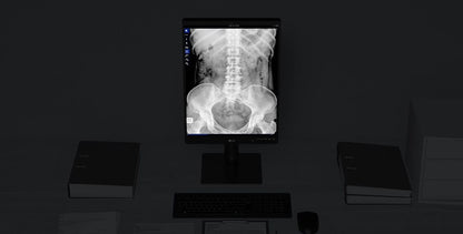 Moniteur de diagnostic LG 21,3'' 3MP IPS, 2048 x 1536, 1100 nits, antireflet