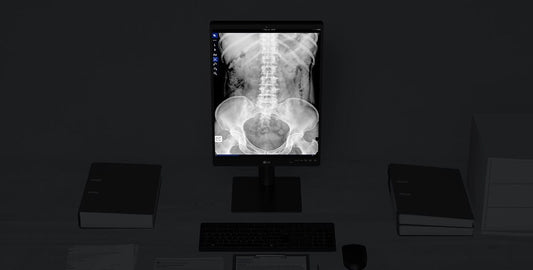 Moniteur de diagnostic LG 21,3'' 3MP IPS, 2048 x 1536, 1100 nits, antireflet