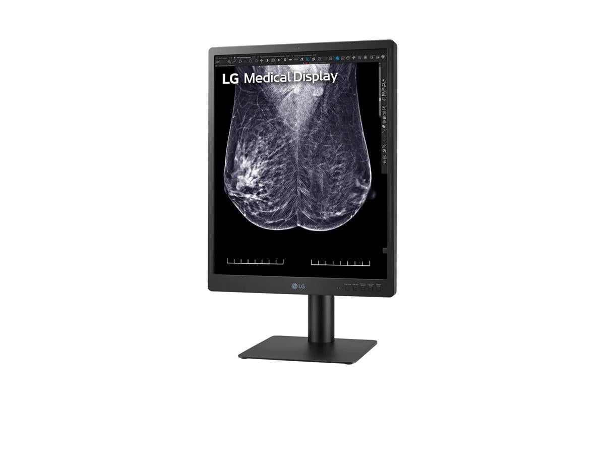 The LG 21HQ613D-B is a 21.3-inch IPS medical-grade diagnostic monitor engineered for accurate and efficient clinical image review. With a native resolution of 2048x2560 and an ultra-bright 1100-nit display, it delivers clear and high-contrast visuals ideal for diagnostic precision. Comprehensive ergonomic features and multiple input interfaces provide flexibility in medical environments.