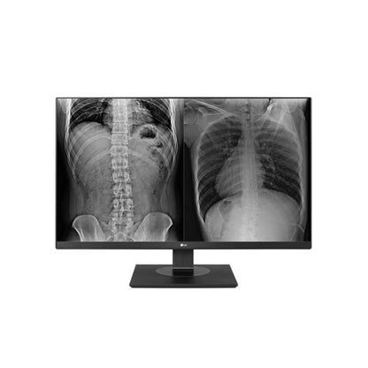 LG 27HJ713C-B 27" 8MP UHD Clinical Monitor, DICOM, HDMI/DP, TAA