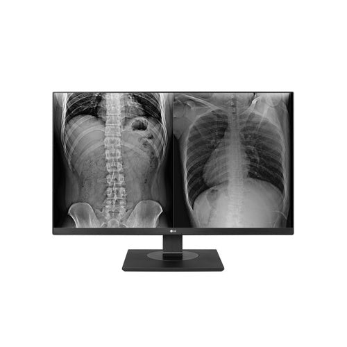 Moniteur clinique LG 27HJ713C-B 27 pouces 8 MP UHD, DICOM, HDMI/DP, TAA
