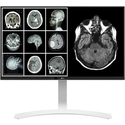LG 27HJ713C-B 27" 8MP UHD Clinical Monitor, DICOM, HDMI/DP, TAA