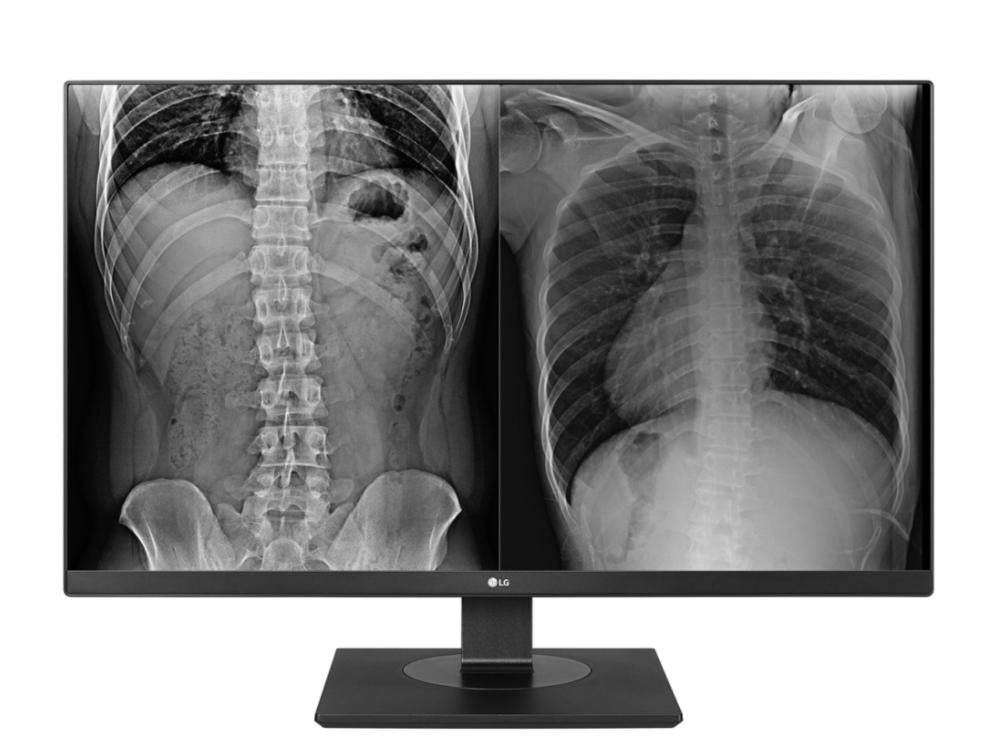 27in LG MEDICAL IPS 8MP UHD 4K CLINICAL MONITOR 3840X2160 DICOM DP FDA CLASS I TAA