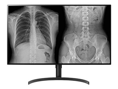 Moniteur de diagnostic médical LG 32HL512D-B 32 pouces 8MP IPS, FDA 510K
