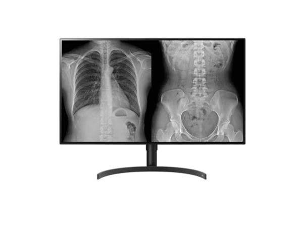 32in LG MEDICAL IPS 8MP DIAGNOSTIC MONITOR 3840 X 2160 DP FDA 510K CLASS II TAA